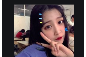 南京維多利亞整形美容醫(yī)院Ranella.Hirsch整形價格表附硅膠墊下巴案例展示