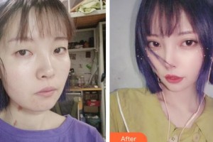 上?，旣愥t(yī)院整形美容中心李云天主診醫(yī)師整形價格表附皮膚清潔補(bǔ)水嫩膚案例展示