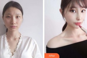 上海陳翌農(nóng)醫(yī)療美容診所陳翌農(nóng)整形價格表附面部吸脂案例展示