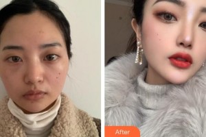 上海樂天整形外科門診部金道演整形價格表附顴骨+下頜角案例展示