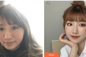 上海原辰醫(yī)療美容醫(yī)院何欣頤整形價(jià)格表附超激光美膚美白嫩膚 祛斑案例展示