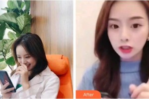 上海文峰醫(yī)療美容門診部寧守國整形價(jià)格表附超聲波潔牙案例展示