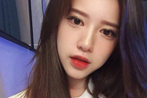 南京斑教授醫(yī)療美容診所張瑞整形價格表附埋線提升案例展示