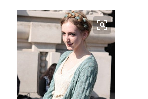 南京斑教授醫(yī)療美容診所芮雪萍整形價(jià)格表附切開雙眼皮案例展示