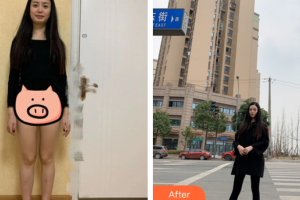 廣州博研醫(yī)療美容門診部顏玲整形價(jià)格表附吸脂瘦大腿案例展示