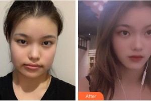 上海百達(dá)麗醫(yī)療美容醫(yī)院王維整形價格表附自然V臉型案例展示