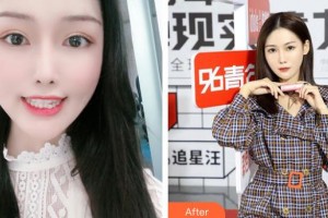 上海百達(dá)麗醫(yī)療美容醫(yī)院董曉瑾整形價格表附隱形矯正案例展示