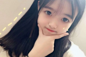 南京美好尉來整形美容診所孫露整形價(jià)格表附面部吸脂案例展示