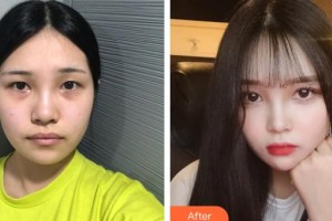 上海新健威醫(yī)療美容門診部錢成寶整形價格表附頜面整形案例展示