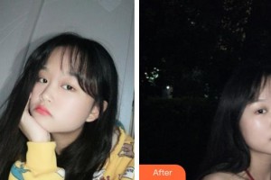 武警上?？傟?duì)醫(yī)院整形美容中心朱麗倩整形價格表附光子嫩膚案例展示