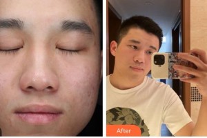 上海二醫(yī)大附屬第九人民醫(yī)院整形激光美容中心劉健航整形價(jià)格表附皮膚管理案例展示