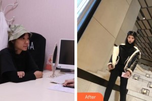 上海歐華醫(yī)療美容門(mén)診部樸麗華整形價(jià)格表附皮膚管理案例展示