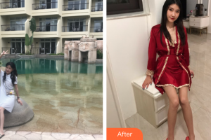 廣州醫(yī)學(xué)院第二附屬醫(yī)院整形美容中心黎志中整形價(jià)格表附白瓷娃娃案例展示