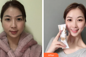 廣州軍美整形醫(yī)院何蘭清整形價(jià)格表附激光美膚祛斑案例展示