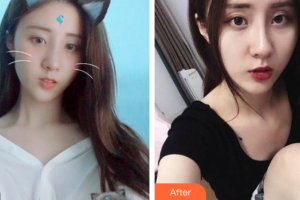 廣州伯明翰醫(yī)療整形美容醫(yī)院唐衛(wèi)華整形價(jià)格表附激光美膚激光祛斑案例展示