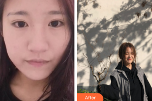 廣州醫(yī)學(xué)院第二附屬醫(yī)院整形美容中心肖和整形價(jià)格表附無針?biāo)獍咐故?>
</a>
<h3 class=