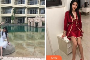 上海市皮膚病醫(yī)院醫(yī)療美容科吳琰瑜整形價格表附白瓷娃娃案例展示