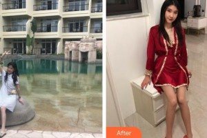 上海時光整形外科醫(yī)院陳文慧整形價格表附白瓷娃娃案例展示