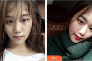 上海芙艾醫(yī)療美容門診部張桂蓉整形價格表附光子嫩膚案例展示