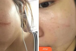 醫(yī)療美容門診部丁曉東整形價格表附祛疤案例展示