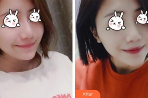 醫(yī)療美容門診部熊師整形價格表附無針水光案例展示