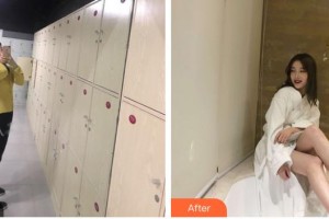 上海時光整形外科醫(yī)院張晶整形價格表附吸脂瘦腰腹案例展示