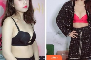 貴州整形美容外科醫(yī)院魯天宇整形價格表附隆胸案例展示