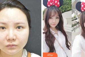 合肥劉大夫美容整形醫(yī)院金問正整形價格表附面部輪廓案例展示