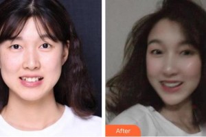 上?？仆呖谇婚T診部季愛萍整形價格表附隱形托槽矯正案例展示