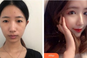上海?，斎鹨曆劭漆t(yī)院郭慶整形價格表附眼部整形案例展示
