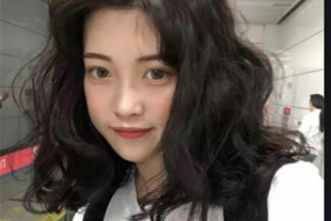 南京市兒童醫(yī)院燒傷整形外科鄒繼軍整形價(jià)格表附隱形托槽矯正案例展示