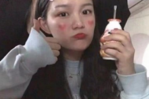 南京智顏醫(yī)療美容門診部榮新華整形價格表附美白導(dǎo)入案例展示