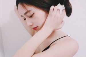 南京愛爾眼科醫(yī)院賀永寧整形價格表附切開雙眼皮案例展示