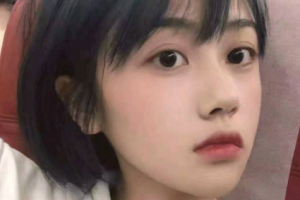 南京醫(yī)科大學(xué)眼科醫(yī)院湯崇凱整形價格表附切開雙眼皮案例展示