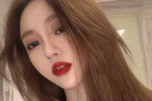 天津武警8630醫(yī)院整形美容中心周茂華整形價(jià)格表附光子嫩膚案例展示