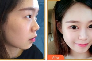 成都美立方（原華博）醫(yī)療美容醫(yī)院弘潤(rùn)基整形價(jià)格表附眼部綜合案例展示