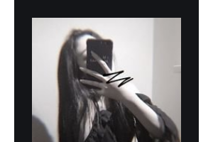 南京雅禾口腔門診部顧森整形價(jià)格表附超聲波潔牙案例展示