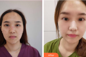 廣州中家醫(yī)家庭醫(yī)生醫(yī)學(xué)整形美容醫(yī)院申汶錫整形價(jià)格表附激光祛痣點(diǎn)痣案例展示