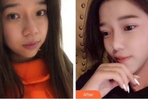 成都艾尚醫(yī)學(xué)美容門診部嚴(yán)新整形價(jià)格表附祛斑案例展示