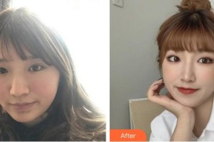 成都艾尚醫(yī)學(xué)美容門診部江海燕整形價(jià)格表附超激光美膚美白嫩膚案例展示