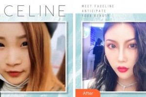 成都金榮醫(yī)學(xué)美容診所張松林整形價(jià)格表附吸脂案例展示