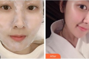 成都漢密爾頓美容醫(yī)院石曉軍整形價(jià)格表附點(diǎn)陣激光案例展示