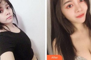 成都莊醫(yī)生醫(yī)學(xué)美容診所楊瀚城整形價(jià)格表附隆胸案例展示