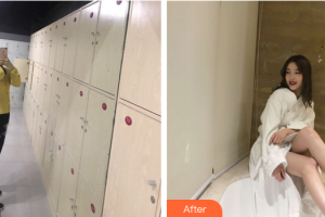 廣州紫馨美容醫(yī)院余創(chuàng)然整形價格表附吸脂瘦腰腹案例展示