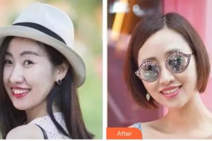 成都嘉美整形美容門診部梁尚爭整形價(jià)格表附口腔-牙齒矯正-隱形托槽矯正案例展示