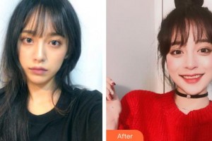 成都米蘭柏羽醫(yī)學(xué)美容醫(yī)院唐桂茹整形價(jià)格表附光子嫩膚案例展示