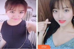 成都華顏醫(yī)療美容門診部宋俊林整形價格表附隆胸案例展示