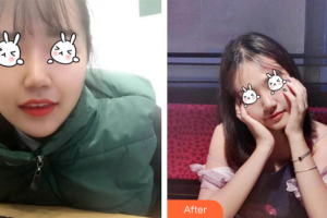 廣州曙光醫(yī)學(xué)美容醫(yī)院李承新整形價(jià)格表附無(wú)針?biāo)獍咐故?>
</a>
<h3 class=