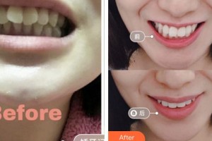 成都華顏醫(yī)療美容門診部王少安整形價格表附牙綜合案例展示