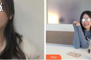 成都華顏醫(yī)療美容門診部何璇整形價格表附紅寶石祛斑案例展示